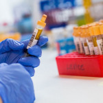 Hygienici eviduju rodinne epidemie a sporadicke ochorenia