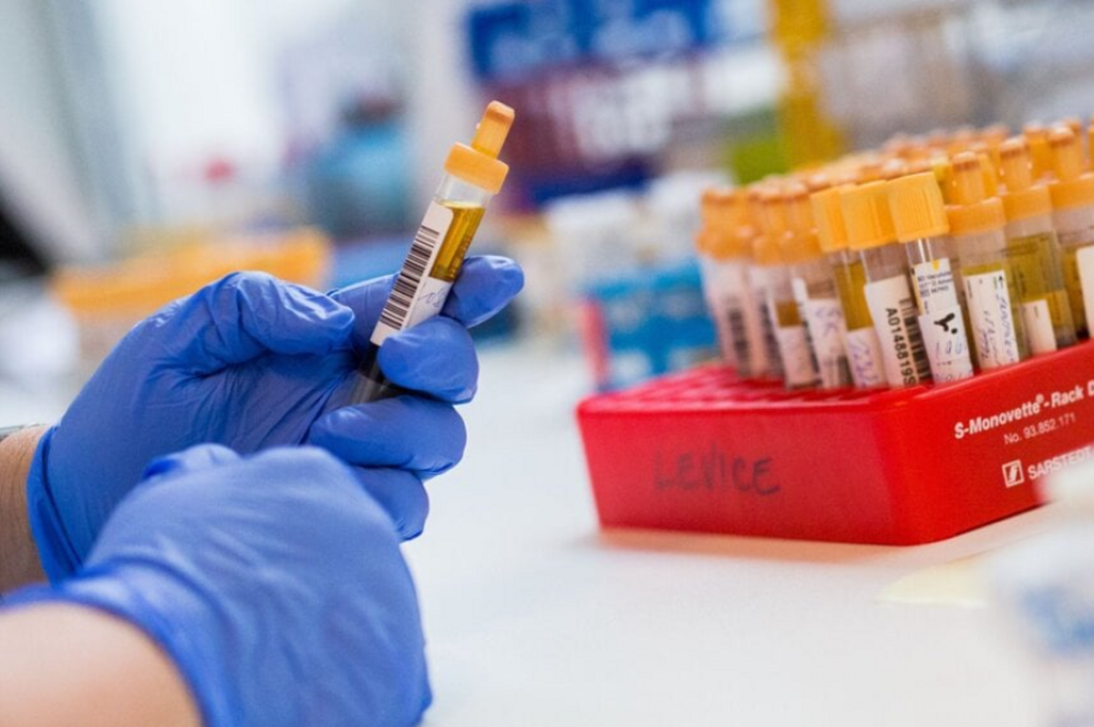 Hygienici eviduju rodinne epidemie a sporadicke ochorenia