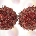 styrom z desiatich pripadov rakoviny sa da predchadzat hlavnym rizikovym faktorom je tabak